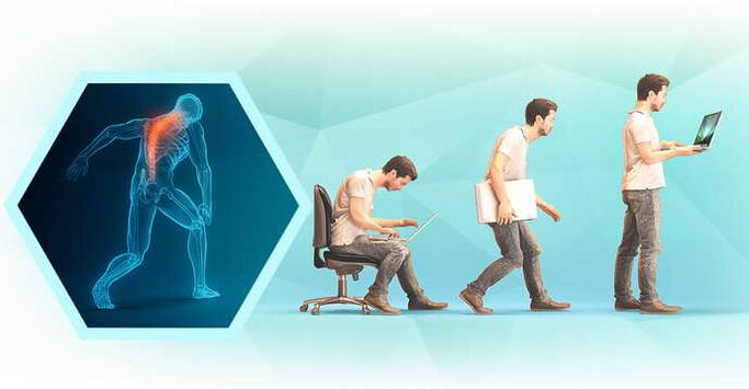 slechte houding bij het werken achter een computer en thoracale osteochondrose