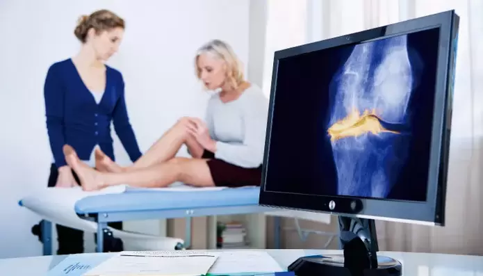 artrose van het gewricht bij een vrouw