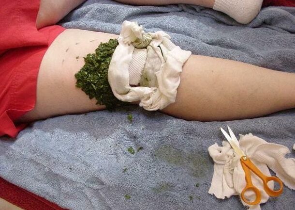 Thuisbehandeling voor knie met kompres